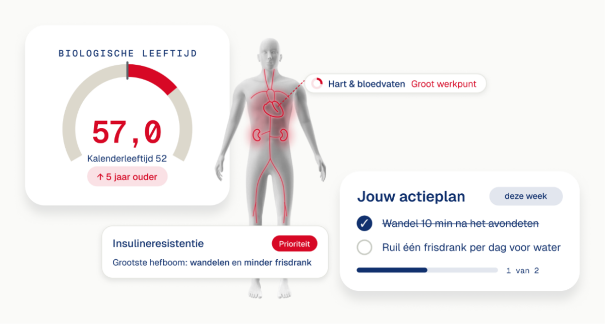 Synapse1-NL